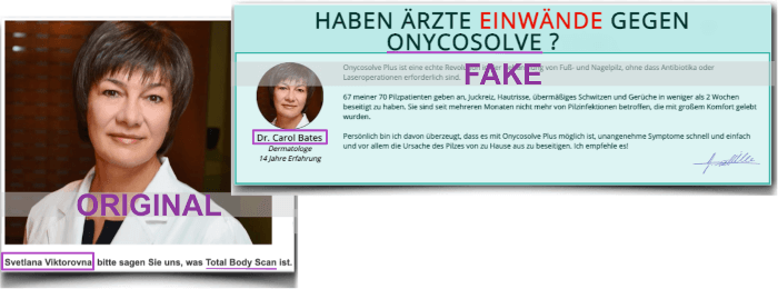 Onycosolve Spray Fake Arztbericht